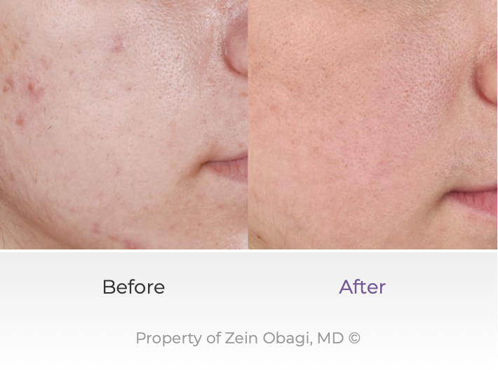 【正規品】Gran NINE Face Slim Booster Serum フェイススリムブースターセラム Face Slim Booster Serum - gran-9
